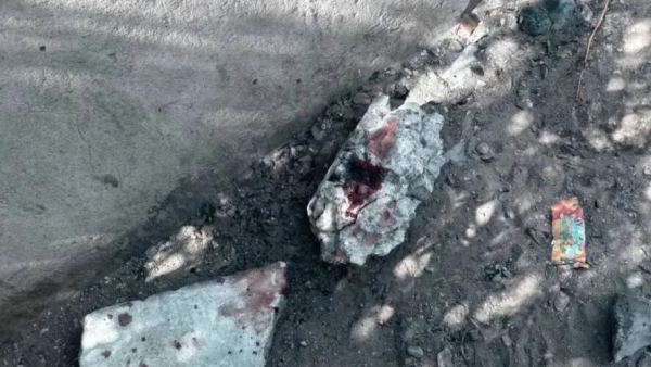 Избили и зарезали подростка, заступившегося за детей у которых отобрали велосипед 06/06/2026 &ndash; Новости